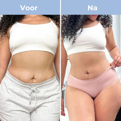 CelluGone™ – Voor een Gladde, Stevige & Zelfverzekerde Huid