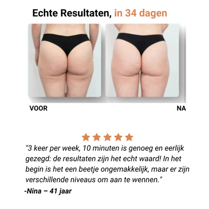 CelluGone™ – Voor een Gladde, Stevige & Zelfverzekerde Huid