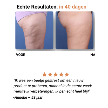 CelluGone™ – Voor een Gladde, Stevige & Zelfverzekerde Huid